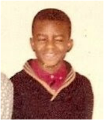 man-with-two-eyes-at-age-11-squinting-with-black-sweater